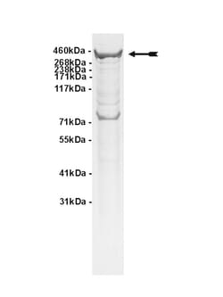 Eurofins DiscoverX ATM Protein, Active 10 &mu;g | Buy Online | Eurofins DiscoverX | Fisher Scientific